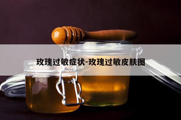 玫瑰过敏症状-玫瑰过敏皮肤图