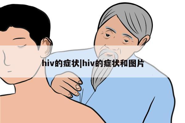 hiv的症状|hiv的症状和图片