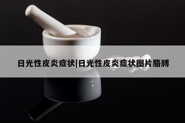 日光性皮炎症状|日光性皮炎症状图片胳膊